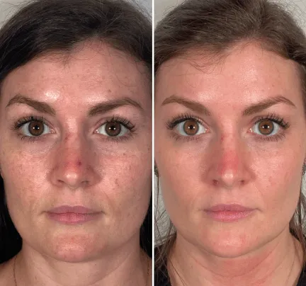 a before and after picture of a woman's face