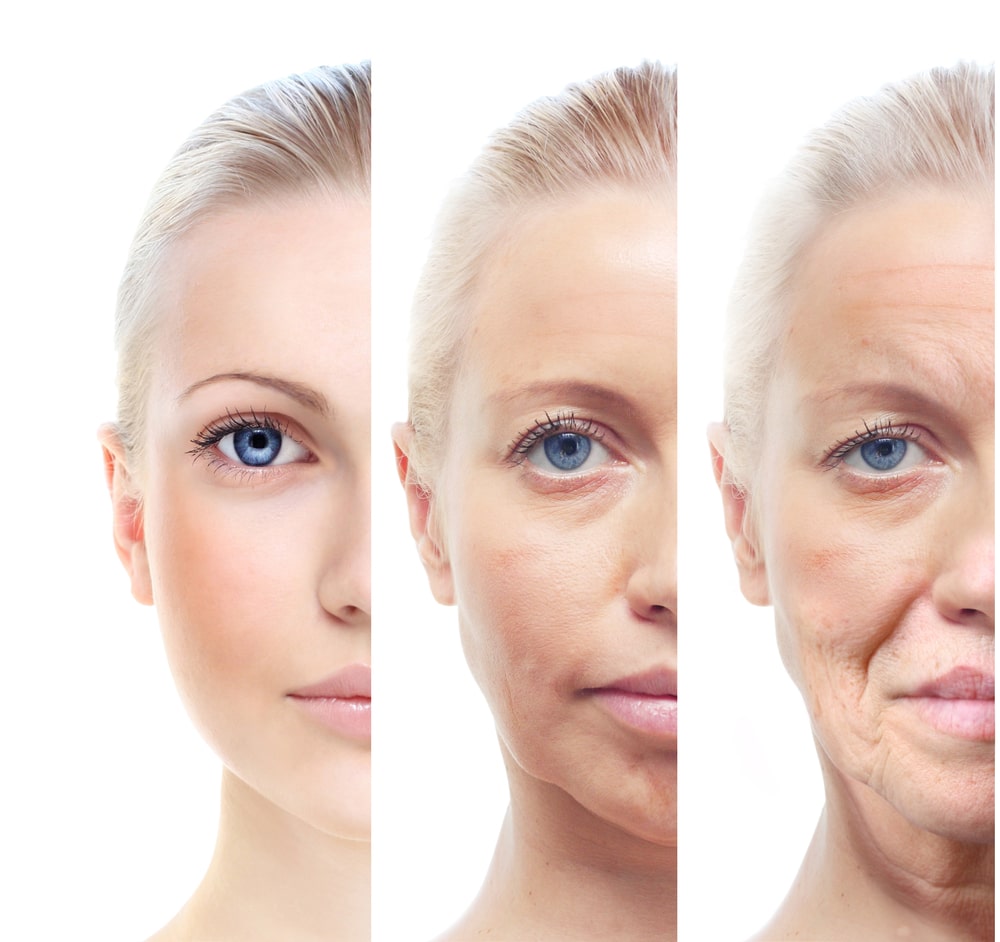 a woman's face before and after a skin tightening procedure