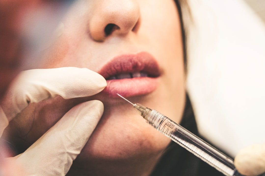 woman getting lip filler.  Debunking Common Myths in Medical Aesthetics