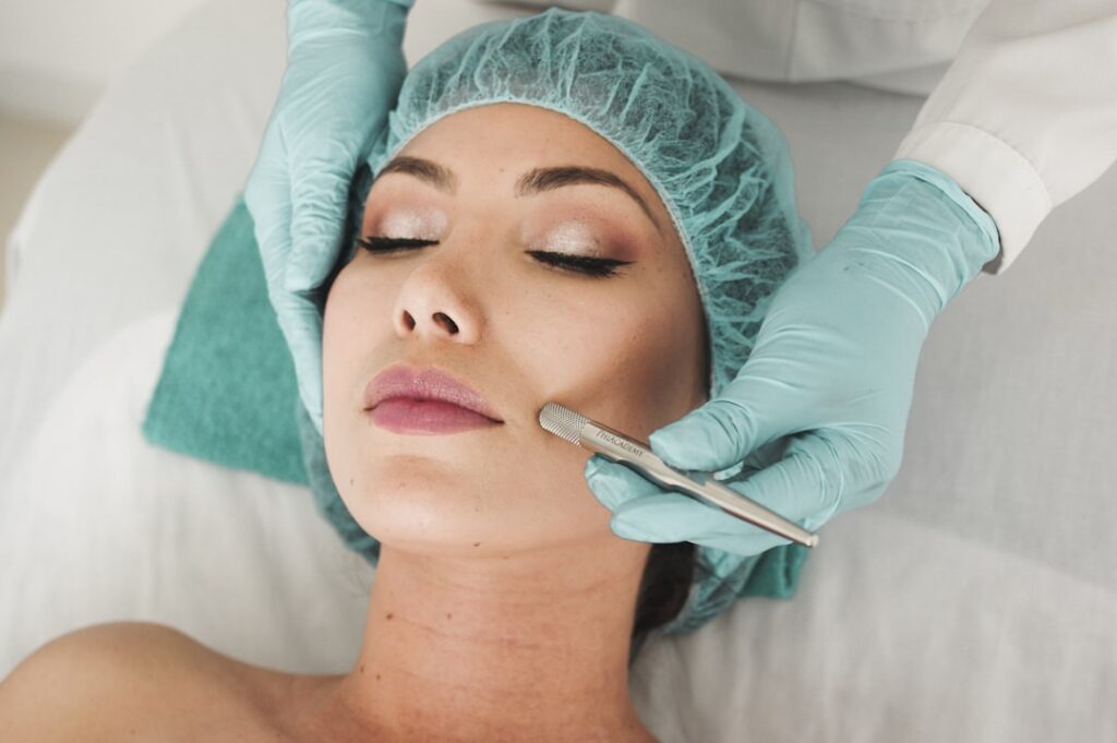 woman doing liposuction on her face. microneedling before and after